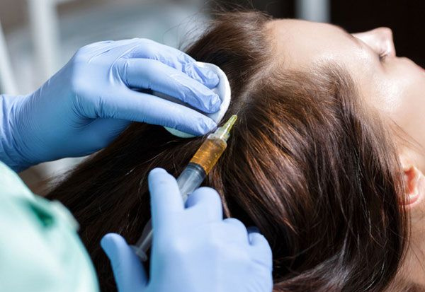 tratamiento capilar con mesoterapia capilar