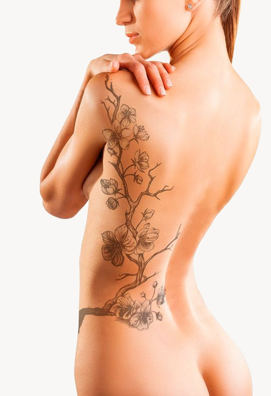 eliminar tatuajes Barcelona