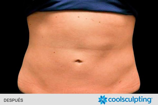 quemar grasa localizada abdomen despuésquemar grasa localizada abdomen después